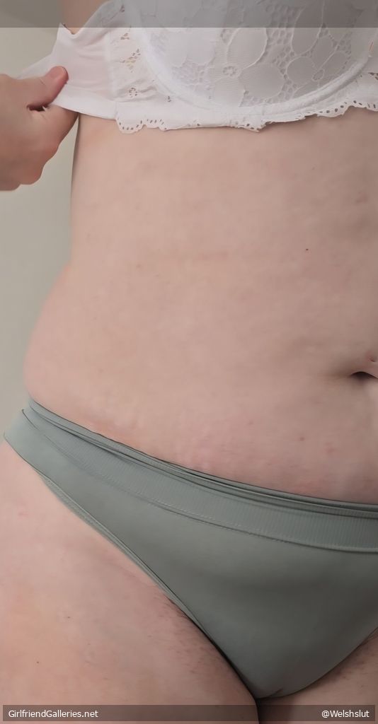 Nipples