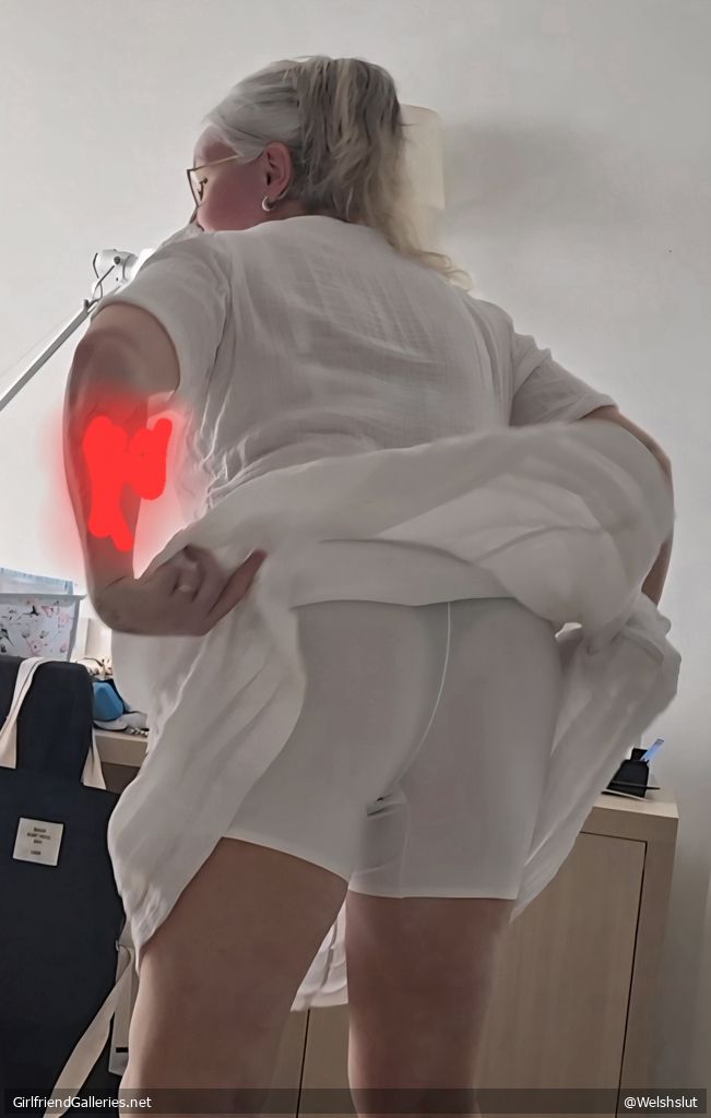 Nipples