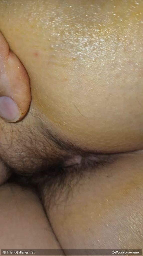 Wife's prickled bum
