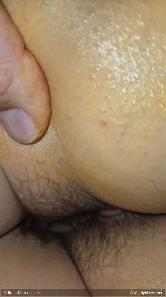 Wife's prickled bum
