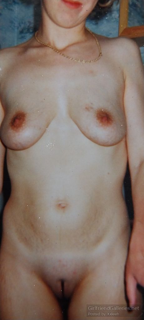 More pregnant/post pregnancy