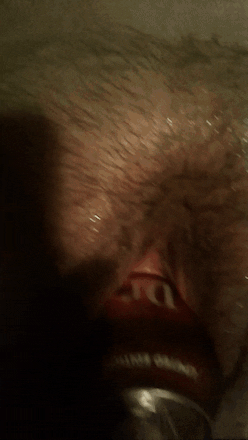 Fisting and Huge Insertion